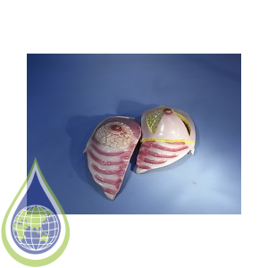 Model, Human Breast Female Set, 1 X Healthy 1 X Ill