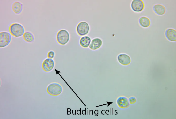 Budding yeast cells observed under SMART Student Biological Microscope for Australian Curriculum experiment.