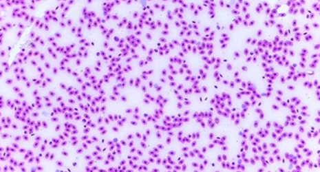 SMART Student Biological Microscope viewing frog blood cells on a prepared slide, showing red blood cells and cellular structure, ideal for teachers and homeschool STEM lessons.